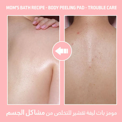 Mom’s Bath Recipe Body Peeling Pad Trouble Care